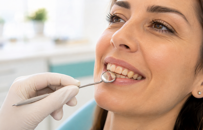 denti_gialli